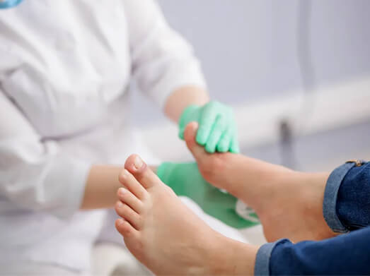 Foto de tratamento de micose